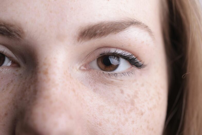 A detailed close-up of a woman's eye and freckles highlighting natural beauty.