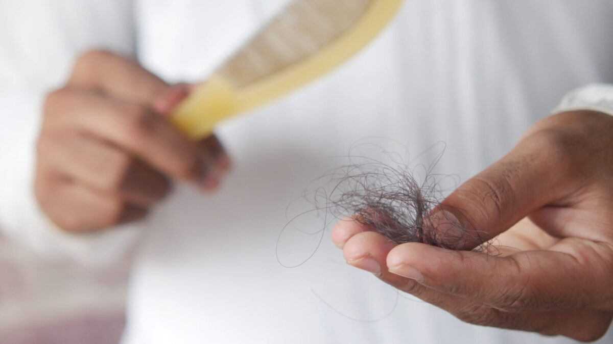 A detailed image showing hair loss with a comb in hand, symbolizing alopecia and related issues.