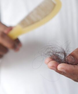A detailed image showing hair loss with a comb in hand, symbolizing alopecia and related issues.