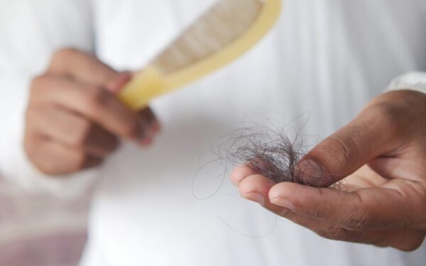 A detailed image showing hair loss with a comb in hand, symbolizing alopecia and related issues.
